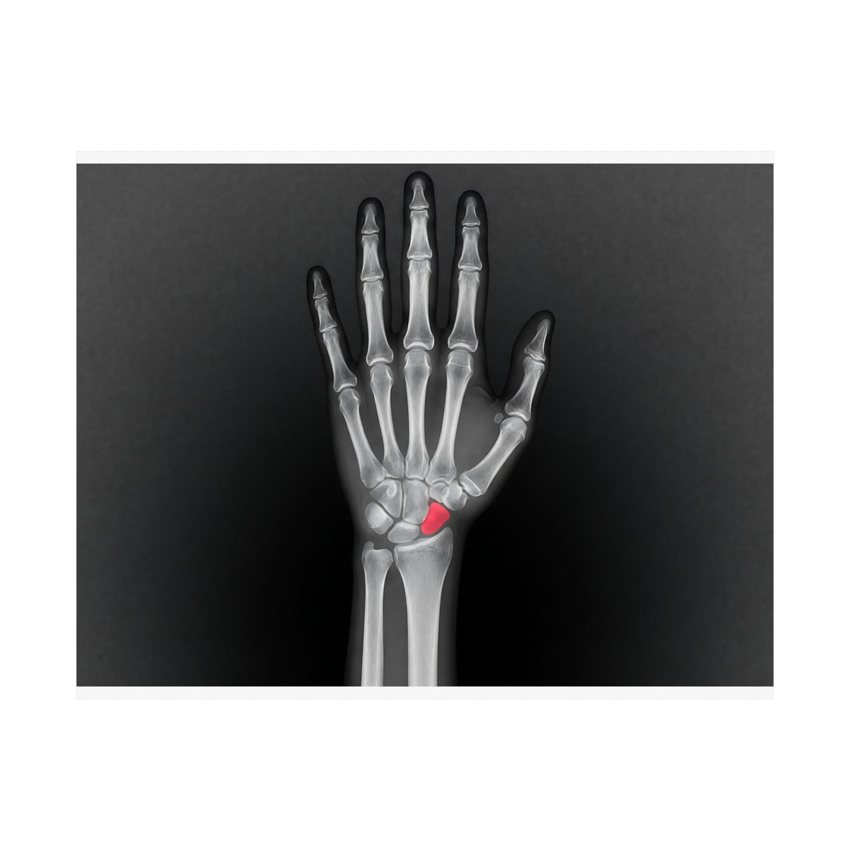 Carpal Study - Doctor's Office Wall Art | Matte Poster (Landscape)