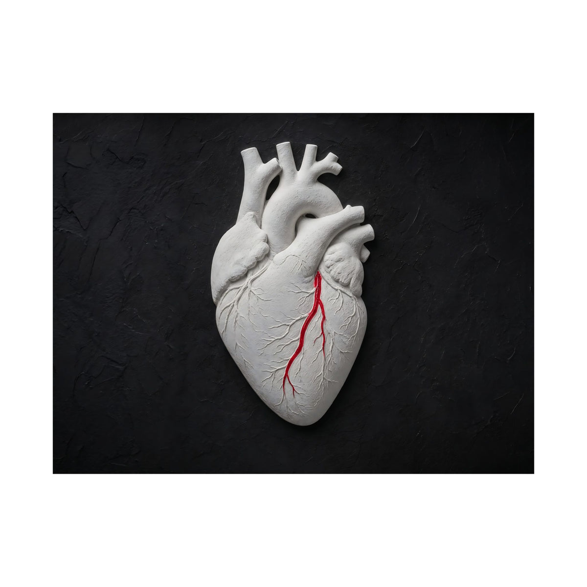 Coronary Path - Doctor's Office Wall Art | Matte Poster (Landscape)