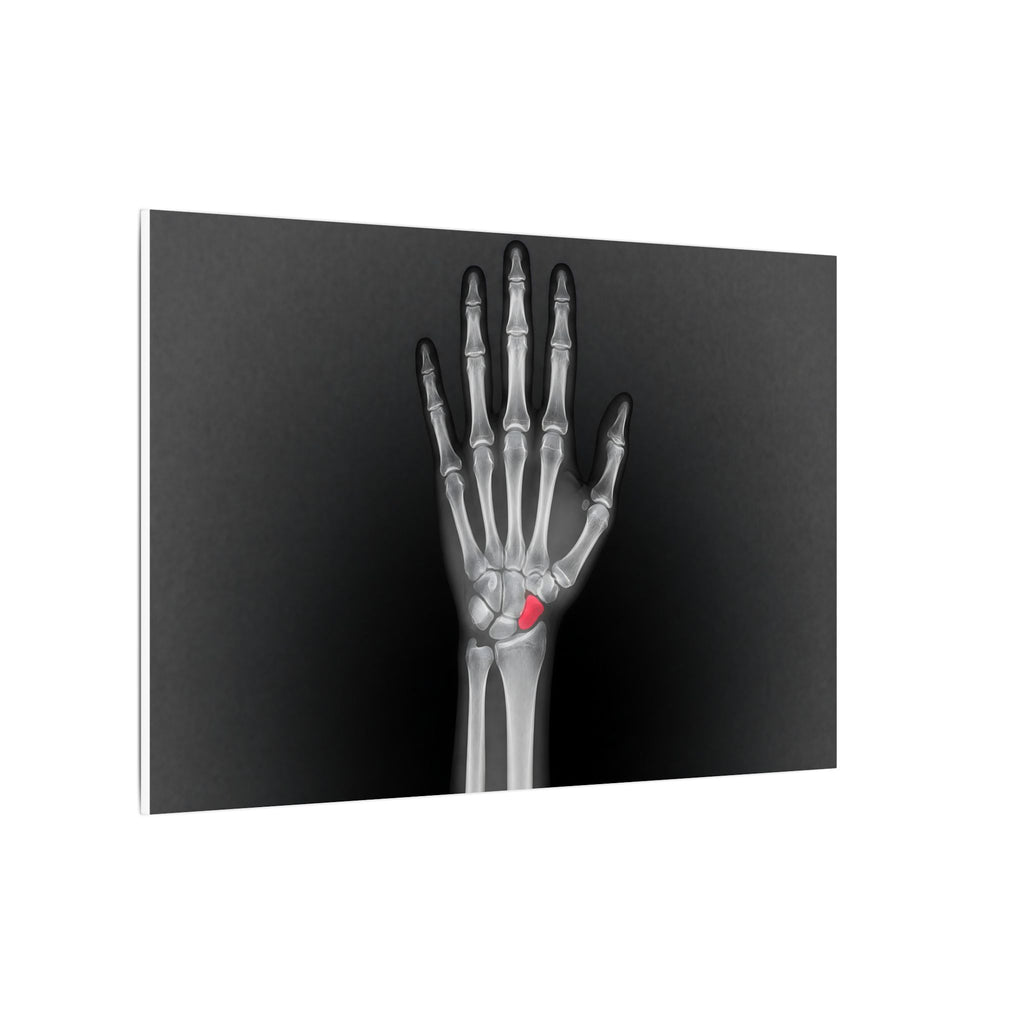 Carpal Study - Doctor's Office Wall Art | Canvas (Landscape)