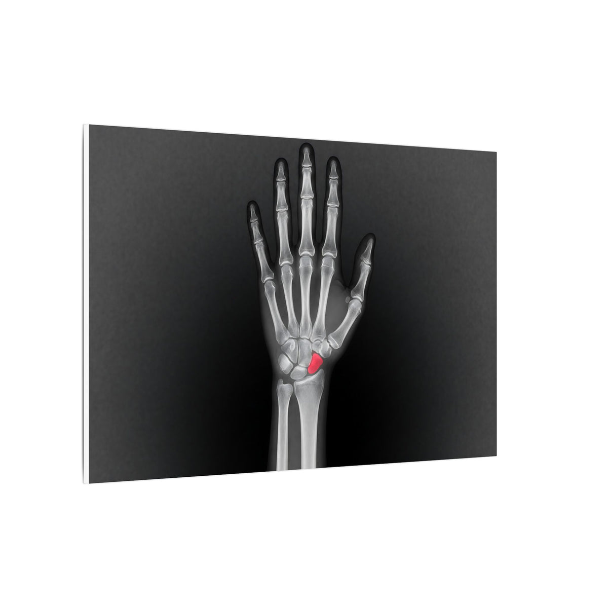Carpal Study - Doctor's Office Wall Art | Canvas (Landscape)