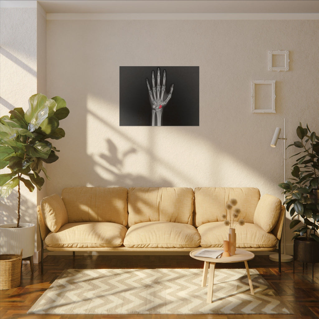 Carpal Study - Doctor's Office Wall Art | Canvas (Landscape)