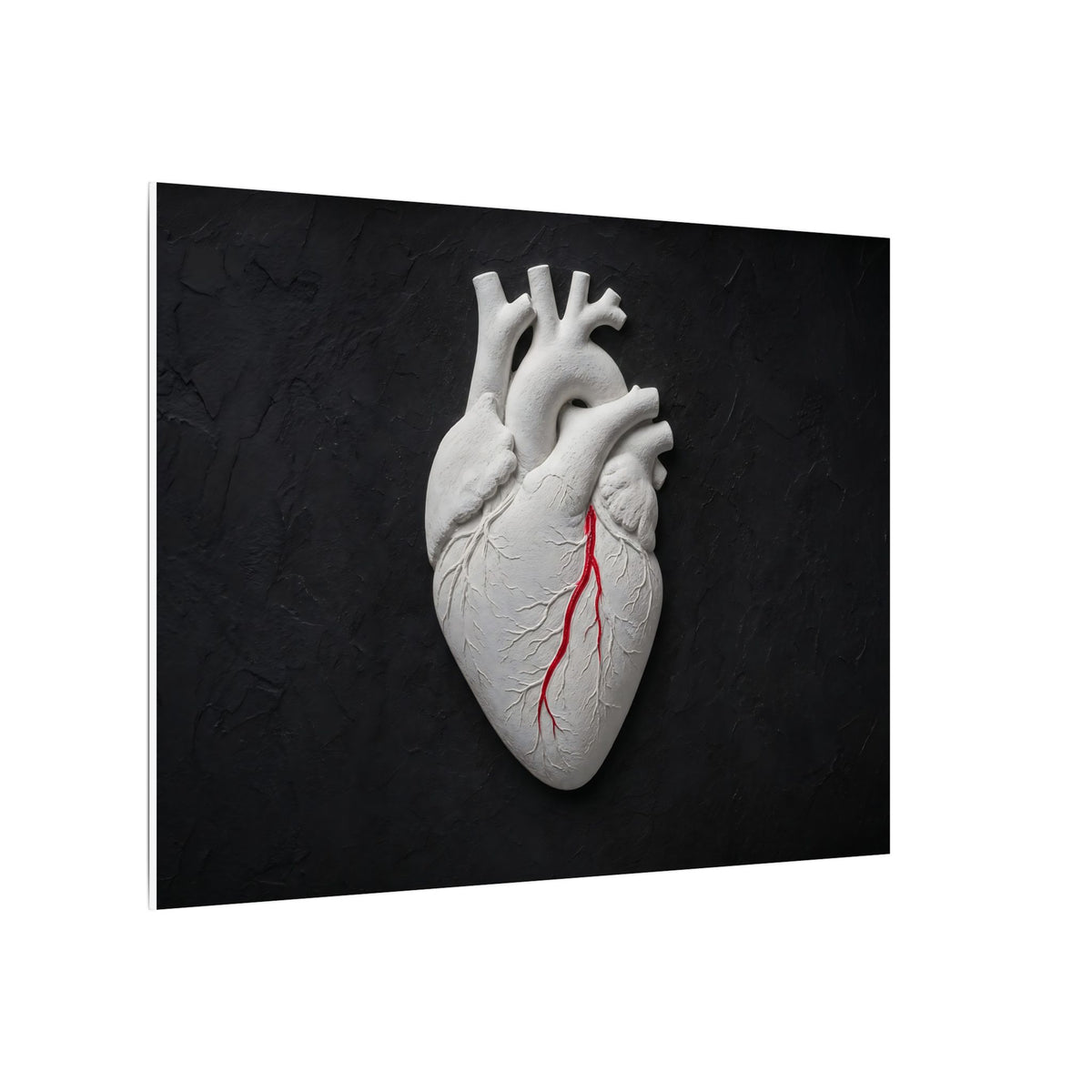 Coronary Path - Doctor's Office Wall Art | Canvas (Landscape)