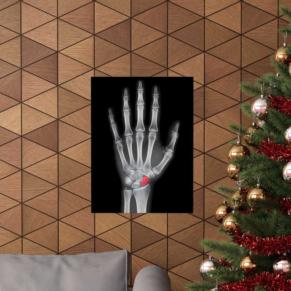 Carpal Study - Doctor's Office Wall Art | Matte Poster