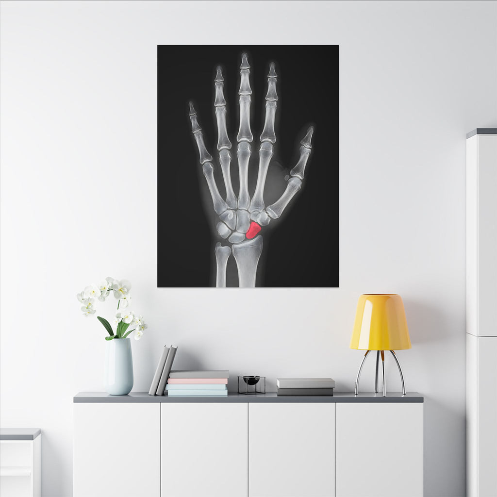 Carpal Study - Doctor's Office Wall Art | Canvas