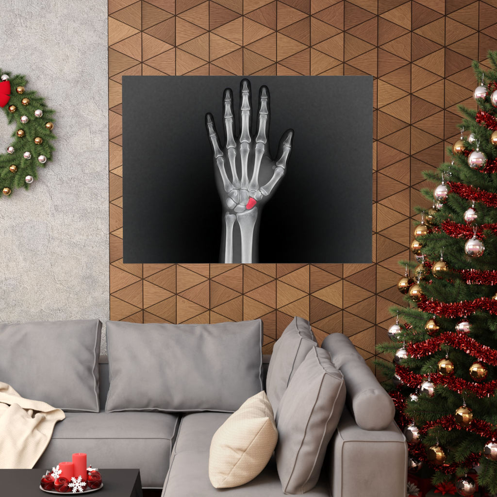 Carpal Study - Doctor's Office Wall Art | Matte Poster (Landscape)