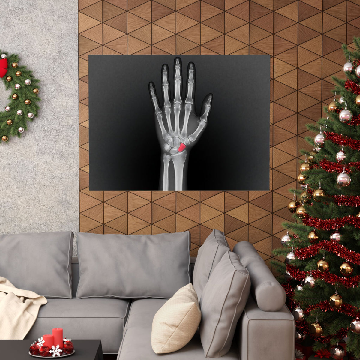 Carpal Study - Doctor's Office Wall Art | Matte Poster (Landscape)