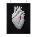 Coronary Path - Doctor's Office Wall Art | Matte Poster