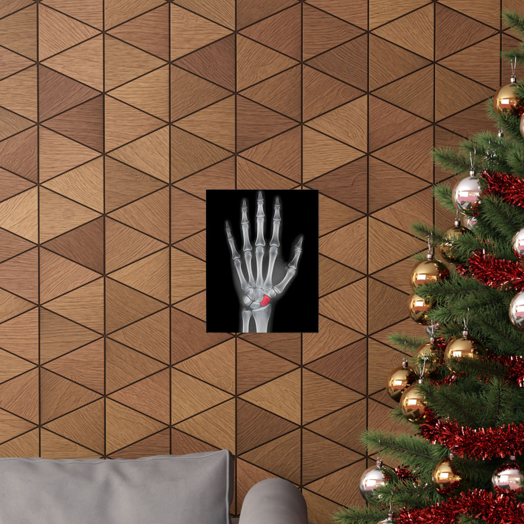 Carpal Study - Doctor's Office Wall Art | Matte Poster