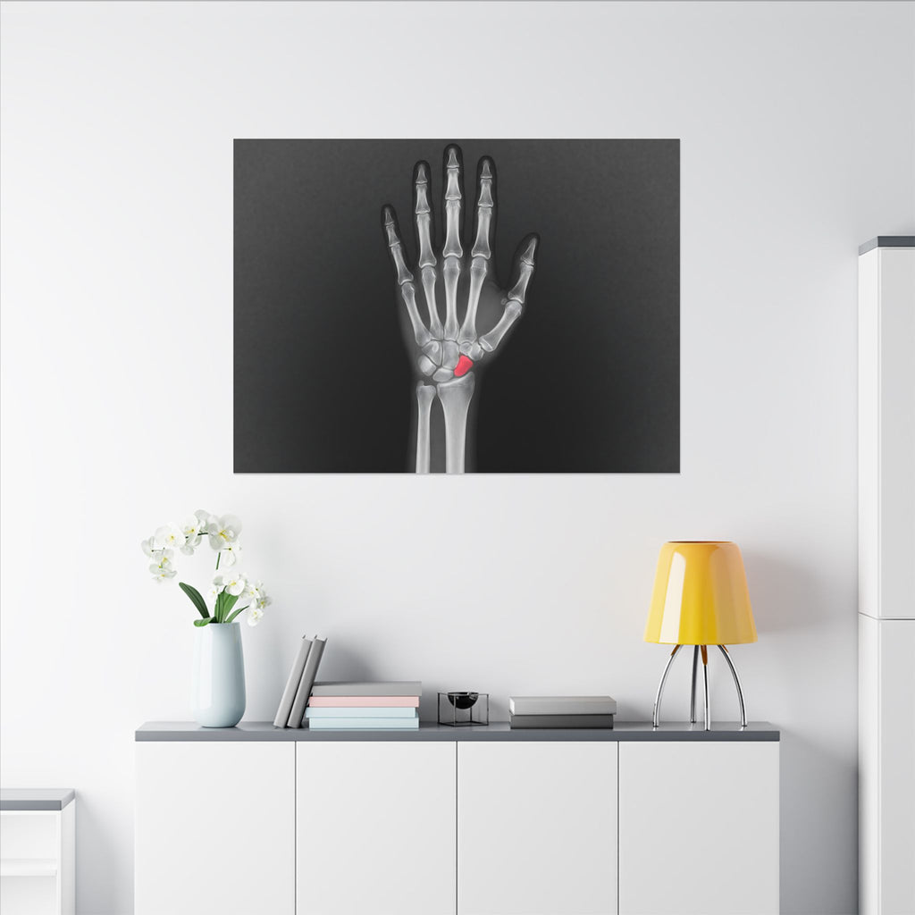 Carpal Study - Doctor's Office Wall Art | Canvas (Landscape)