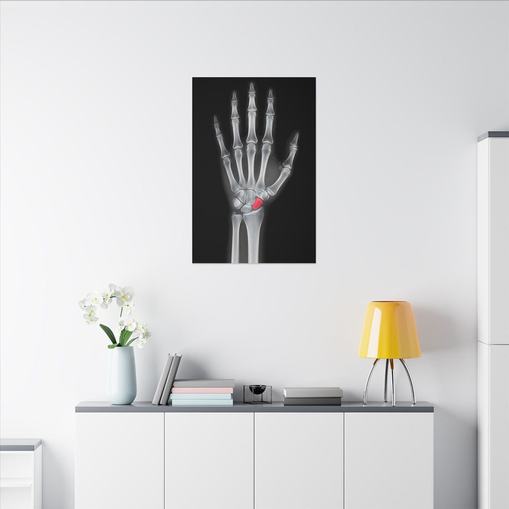 Carpal Study - Doctor's Office Wall Art | Canvas