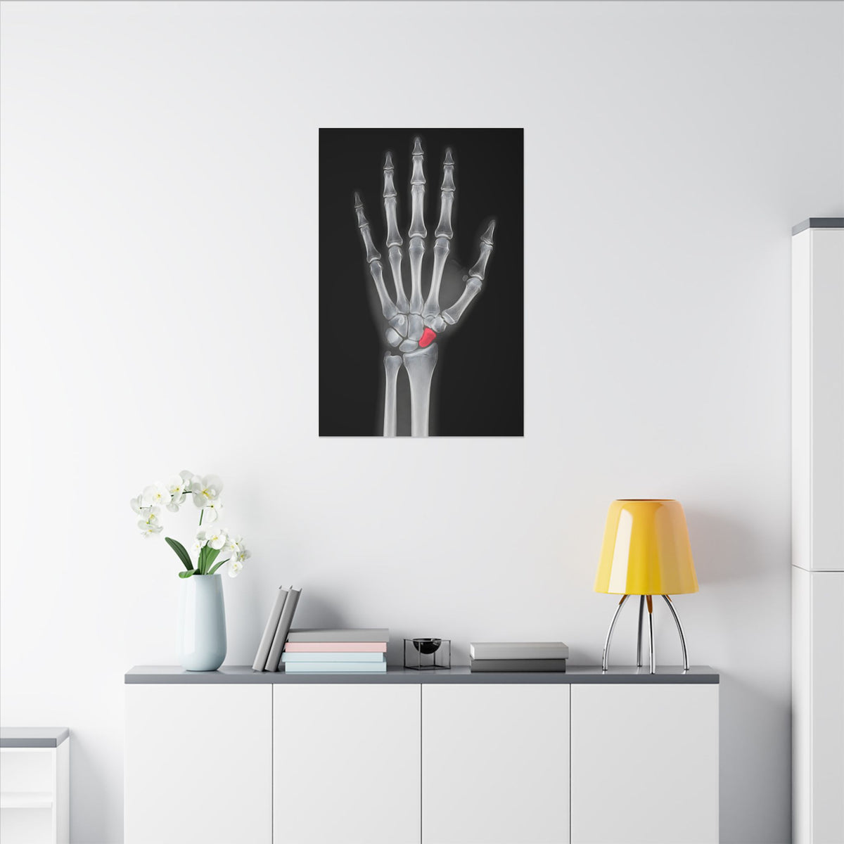 Carpal Study - Doctor's Office Wall Art | Canvas