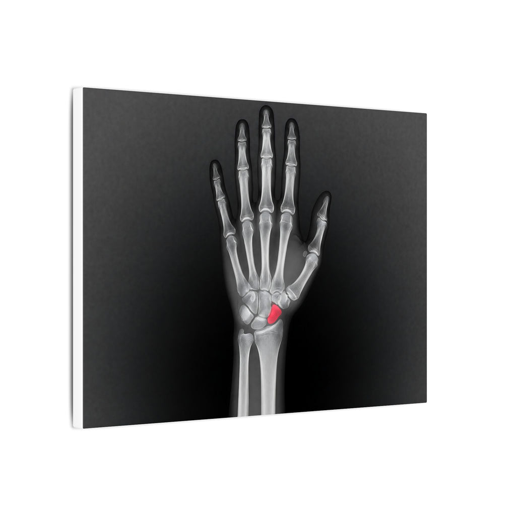 Carpal Study - Doctor's Office Wall Art | Canvas (Landscape)
