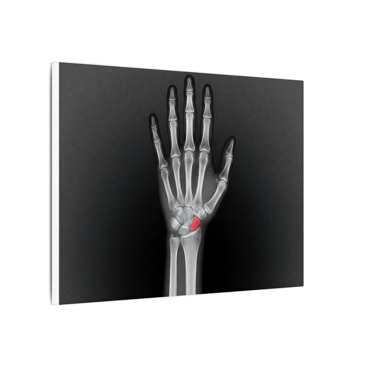 Carpal Study - Doctor's Office Wall Art | Canvas (Landscape)