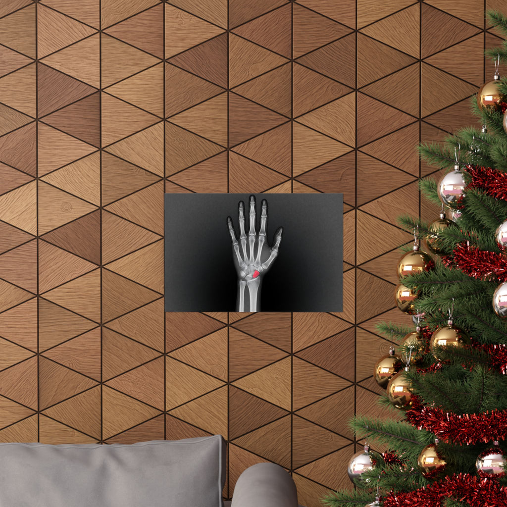 Carpal Study - Doctor's Office Wall Art | Matte Poster (Landscape)