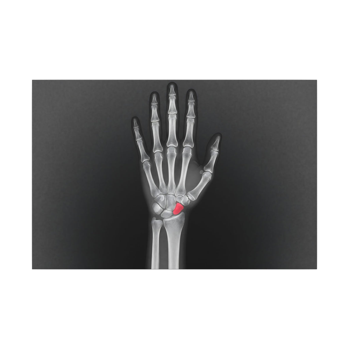 Carpal Study - Doctor's Office Wall Art | Canvas (Landscape)